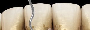 dallas periodontal health