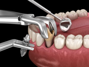 richardson prosthetic dentistry