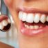 Your Periodontal Health Matters