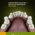 Treating Misalignment Helps Prevent Major Oral Health Problems!