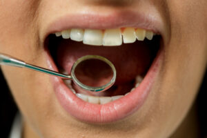 richardson dental exam