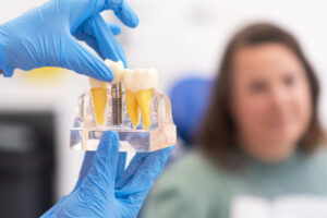 richardson dental implants