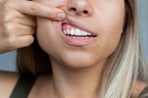 dallas gum health