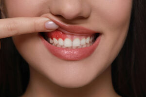 richardson gum health